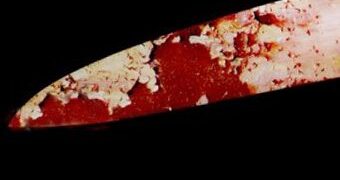 28-годишен намушка братята си с нож в гърба, единият е с опасност за живота